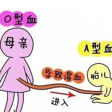 abo溶血长大没事吧