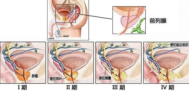 男性生殖系统症状