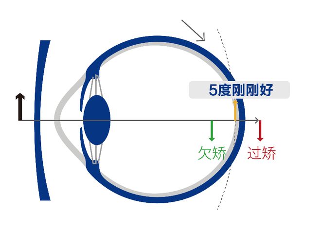 焦度计测量眼镜视频