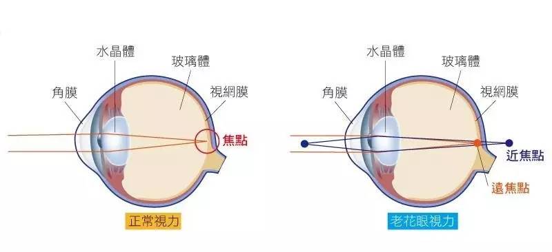 眼睛近视能治疗好吗