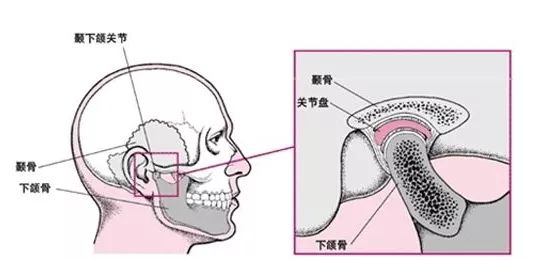 下巴脱臼会自己恢复吗,科学分析解析说明_Z79.39.70